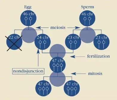 Diagram of nondisjunction: during meiosis the 21st chromosome pair fails to separate, producing an egg with 24 chromosomes and a discarded cell with 22. After fertilisation by a sperm carrying 23 chromosomes the cell has 47, and every cell produced by mitosis carries 47.